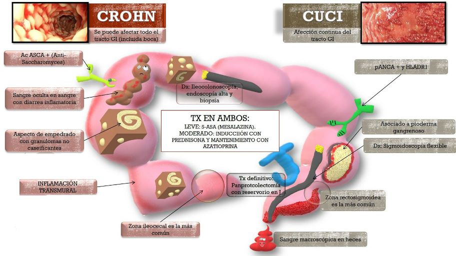 tratamiento cucci y chron León Guanajuato