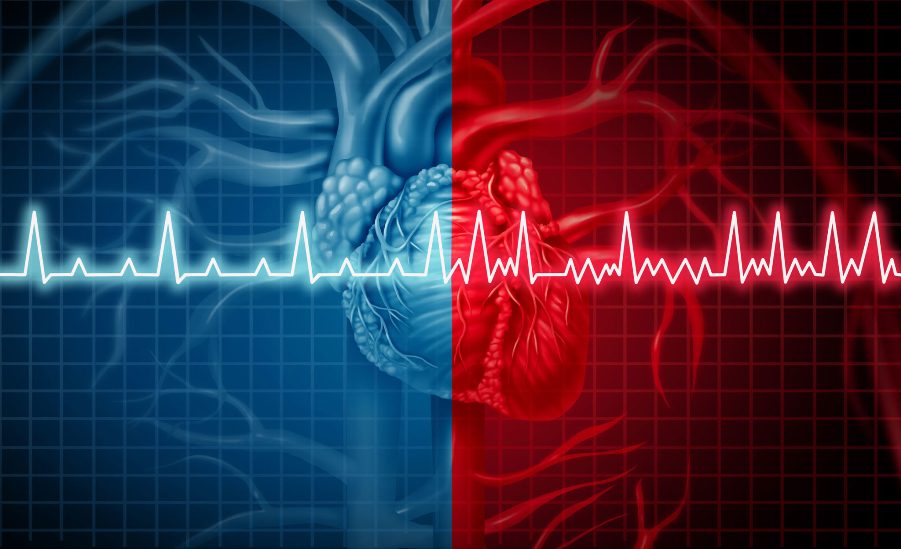 electrocardiogramas en León Guanajuato